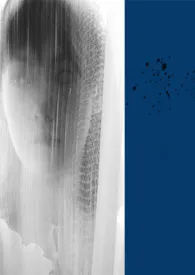 《怪你过分美丽》1970版小说全集 赤焰小怪物完本作品